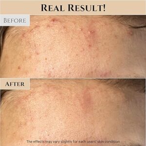 Beauty of Joseon Ground Rice and Honey Glow Mask Pore Sebum Care for Dry Sensitive Skin Korean Skin Care 150ml, 5.07 fl.oz - Image 3