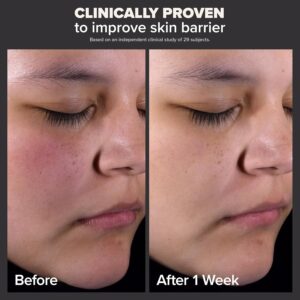 Paula's Choice SKIN PERFECTING 2% BHA Liquid Salicylic Acid Exfoliant-Facial Exfoliant for Blackheads, Enlarged Pores, Wrinkles & Fine Lines - Image 4